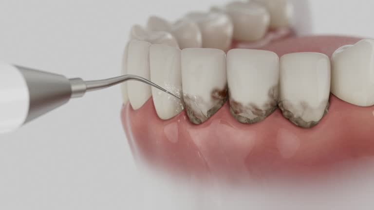 Reliable Dental Implants contractor in Meadowbrook, VA by Smile Center Dentistry